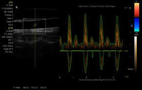 XF-7800彩色多普勒超声诊断仪成像展示